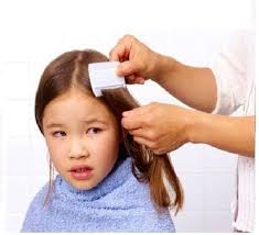 مشط فلايه صغير